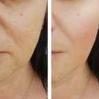 EXFOLIANT A L'ACIDE AZELAIQUE ET NOYEUX D'ABRICOT