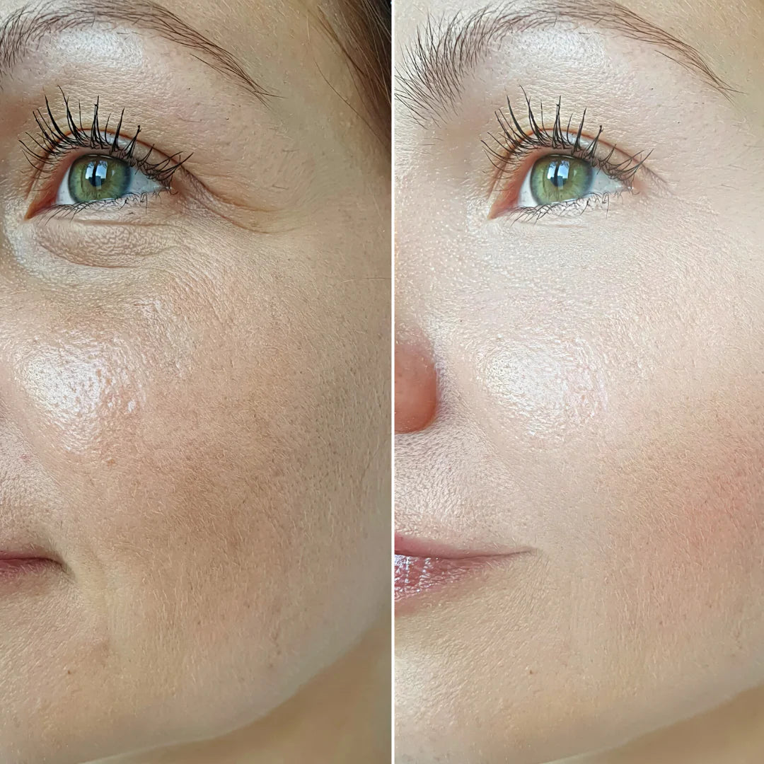 LOTION EXFOLIANTE EQUILIBRANTE PROFESSIONNELLE